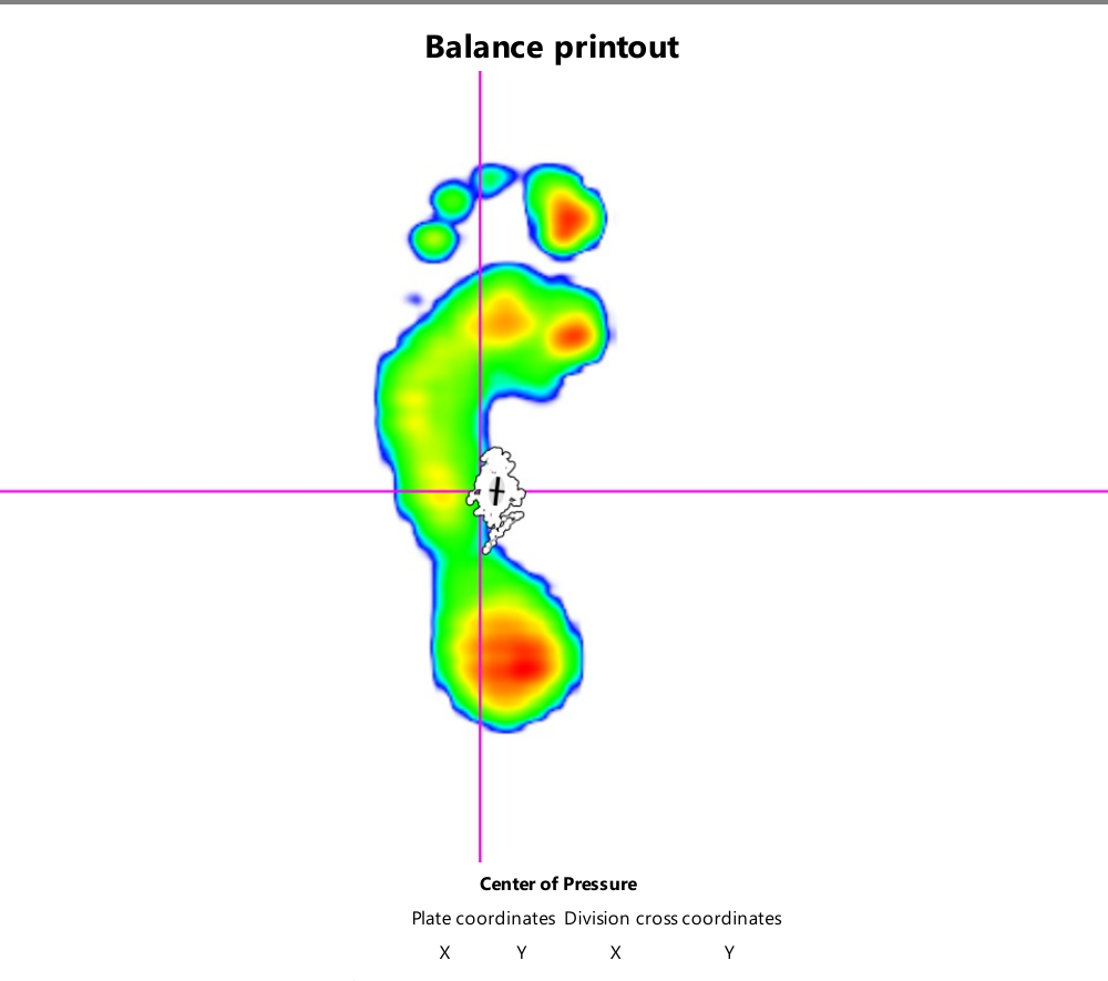 Balance pressure printout
