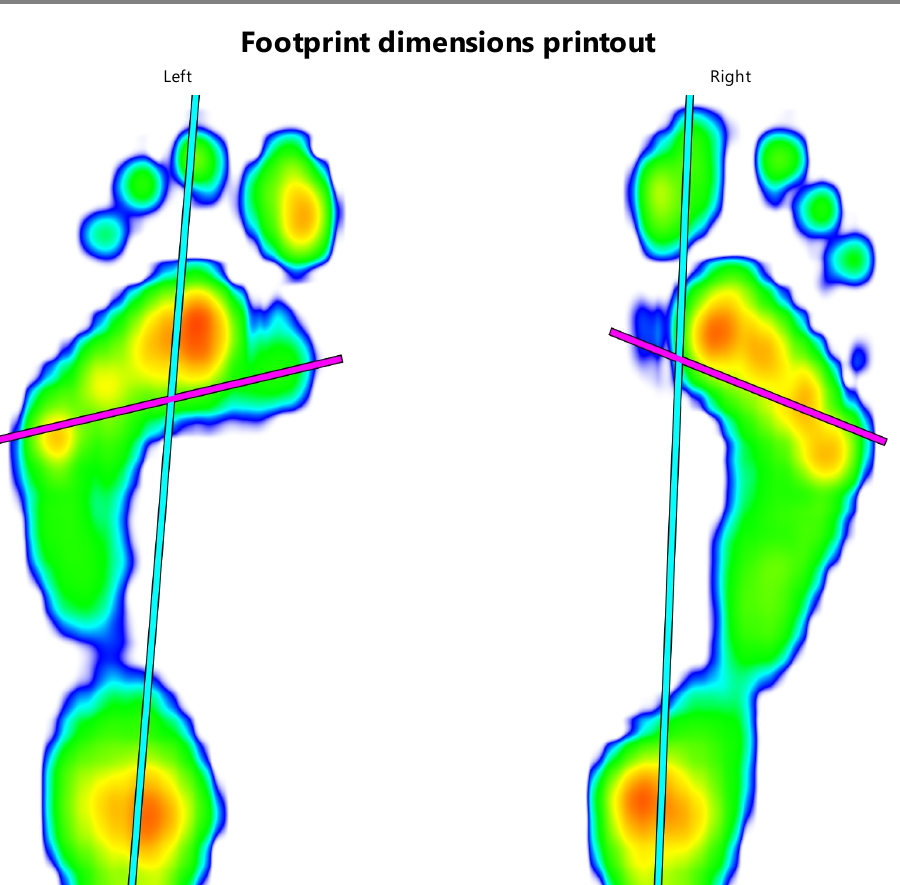 Footprint dimensions pressure analysis
