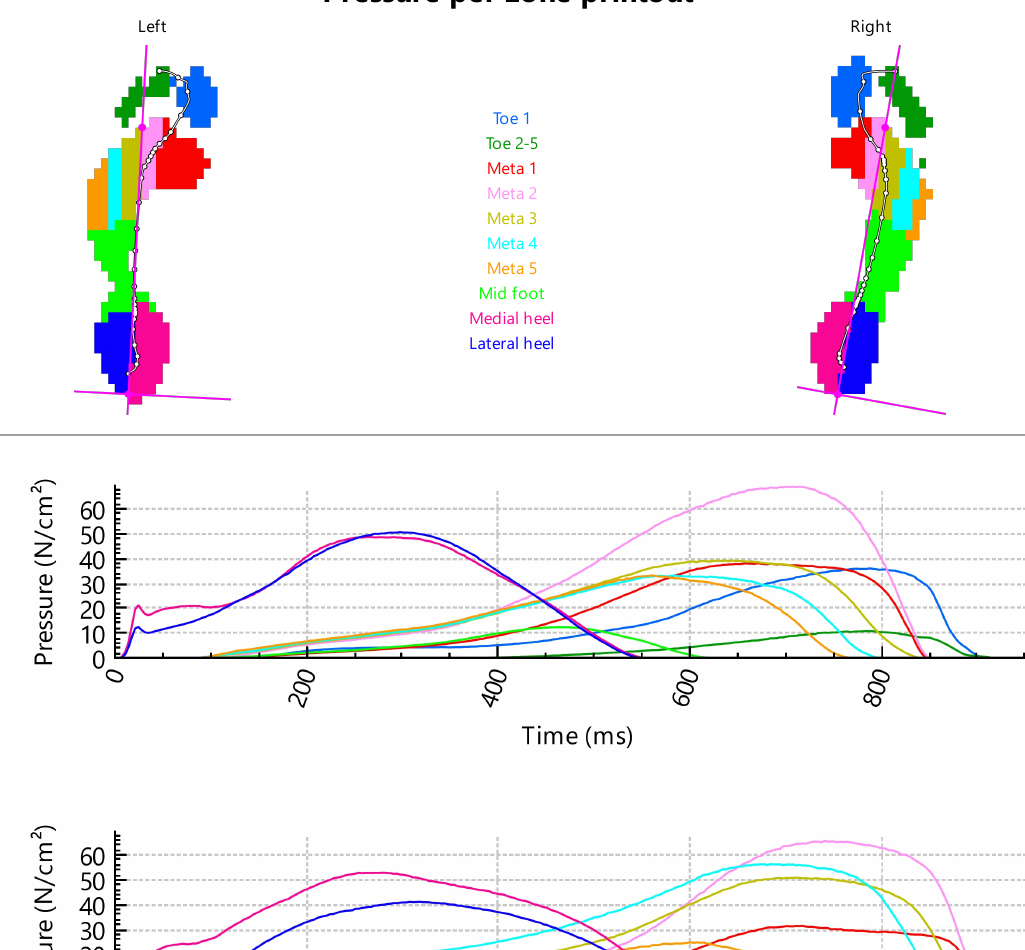 Pressure per zone gait analysis graphs