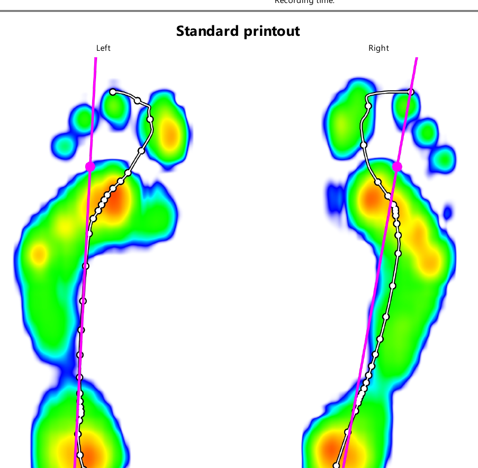 Gait pressure printout with centre of pressure path