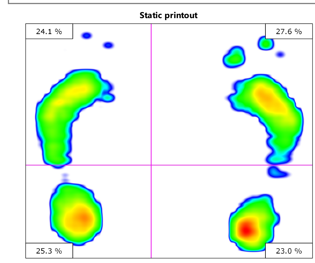Static pressure footprint analysis